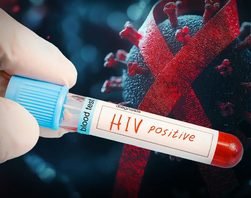 ထိုင်းနိုင်ငံအတွင်း HIV ကူးစက်မှုအသစ်၏ သုံးပုံတစ်ပုံသည် လူငယ်များဖြစ်နေ